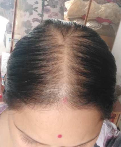 Image #1 from Radhika dona