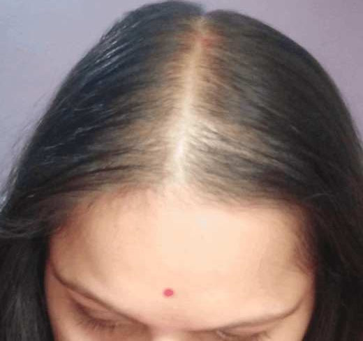 Image #2 from Radhika dona