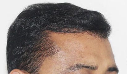 Image #2 from Varma Raj